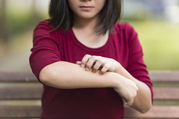 Close up of girl scratching her arm
