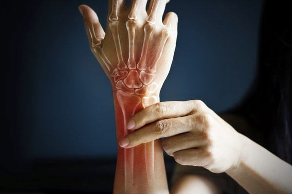 Close up of woman holding her wrist with bones superimposed on it